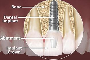 Beyond Teeth: What’s Inside Your Mouth